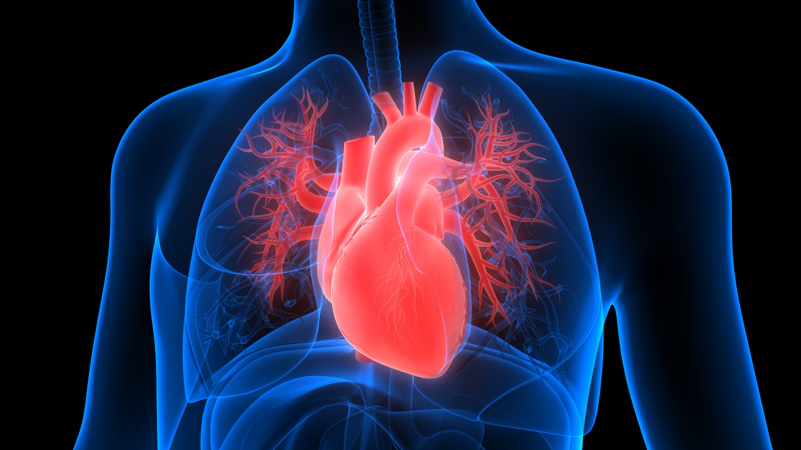 cardiac resynchronization therapy